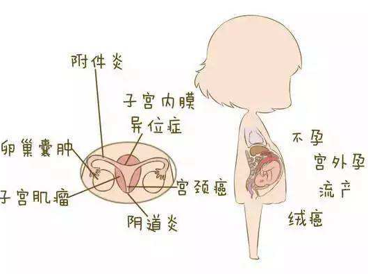 阴道分泌物JK漫画在线观看分析阴道炎早期症状