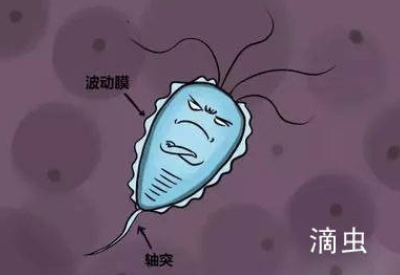 白带JK漫画在线观看品牌介绍滴虫性阴道炎的早期症状以及预防方法