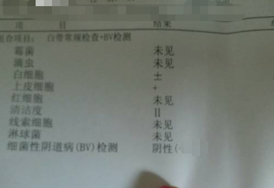全自动白带JK漫画软件APP分享如何看懂白带常规检测报告单